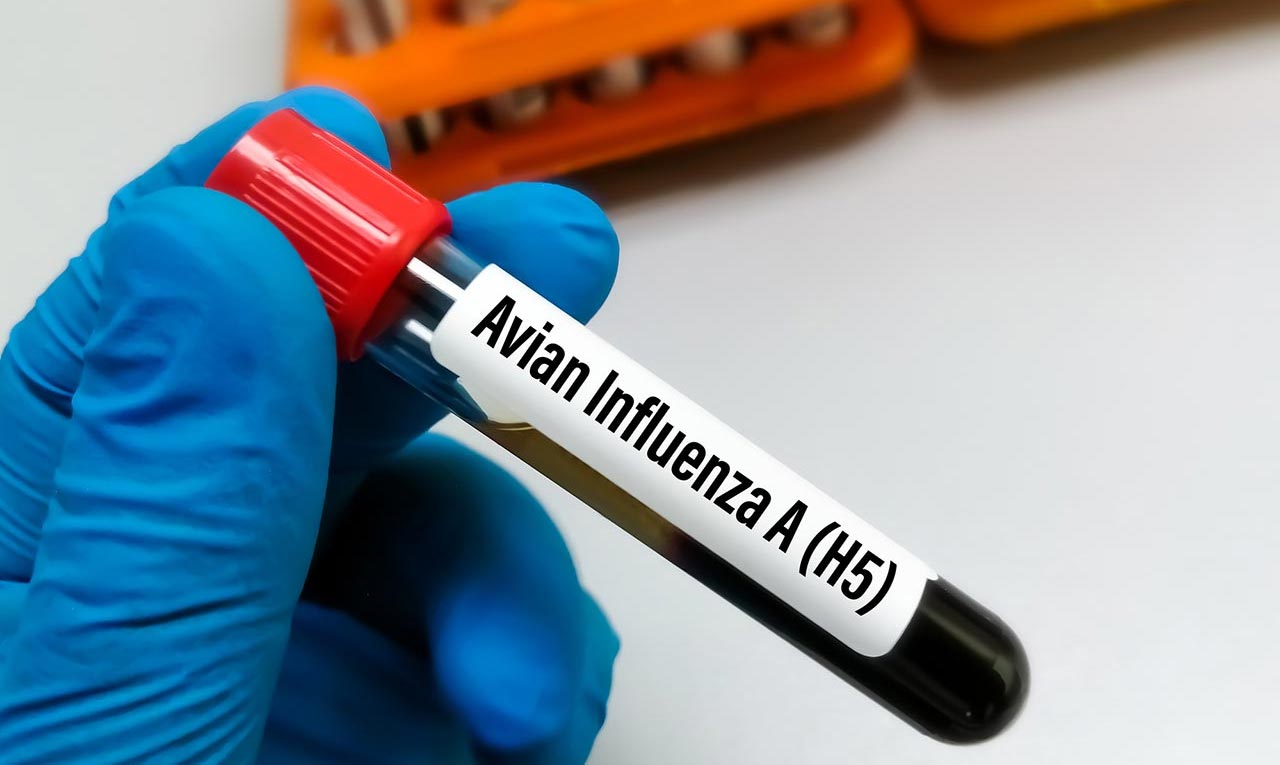 Blood sample labelled Avian Influenza A H5